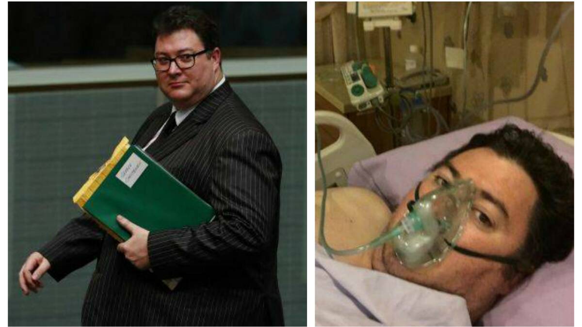 Nationals MP George Christensen, pictured in February 2017 before his surgery and An image shared by Christensen following his surgery.