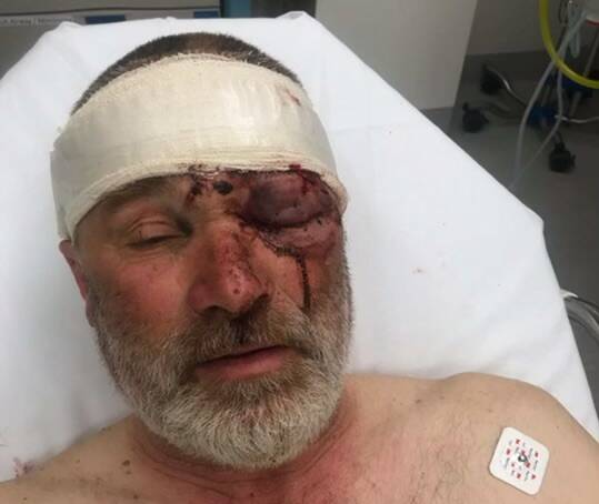 'I'm lucky to be here', farmer says after horrific motorbike accident
